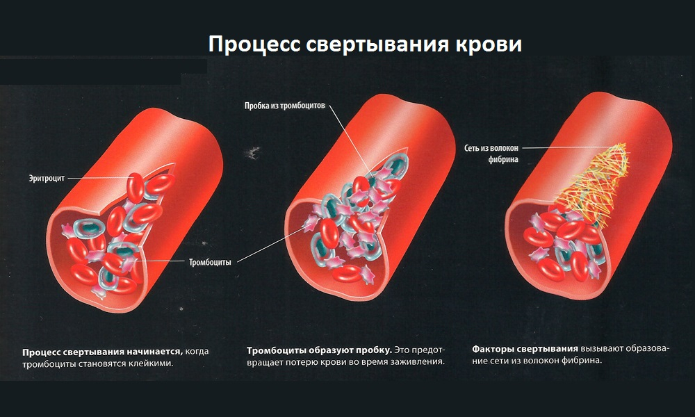 схема свертывания крови